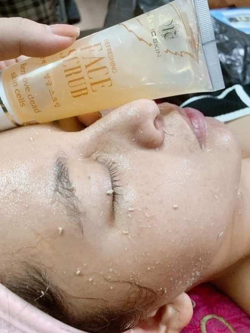 TẨY DA CHẾT DỊU NHẸ MAGICSKIN